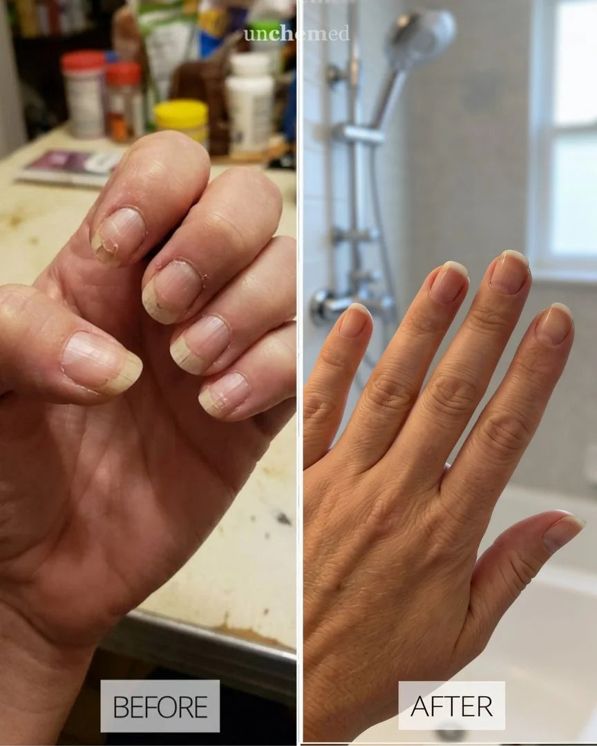Before and after with Unchemed