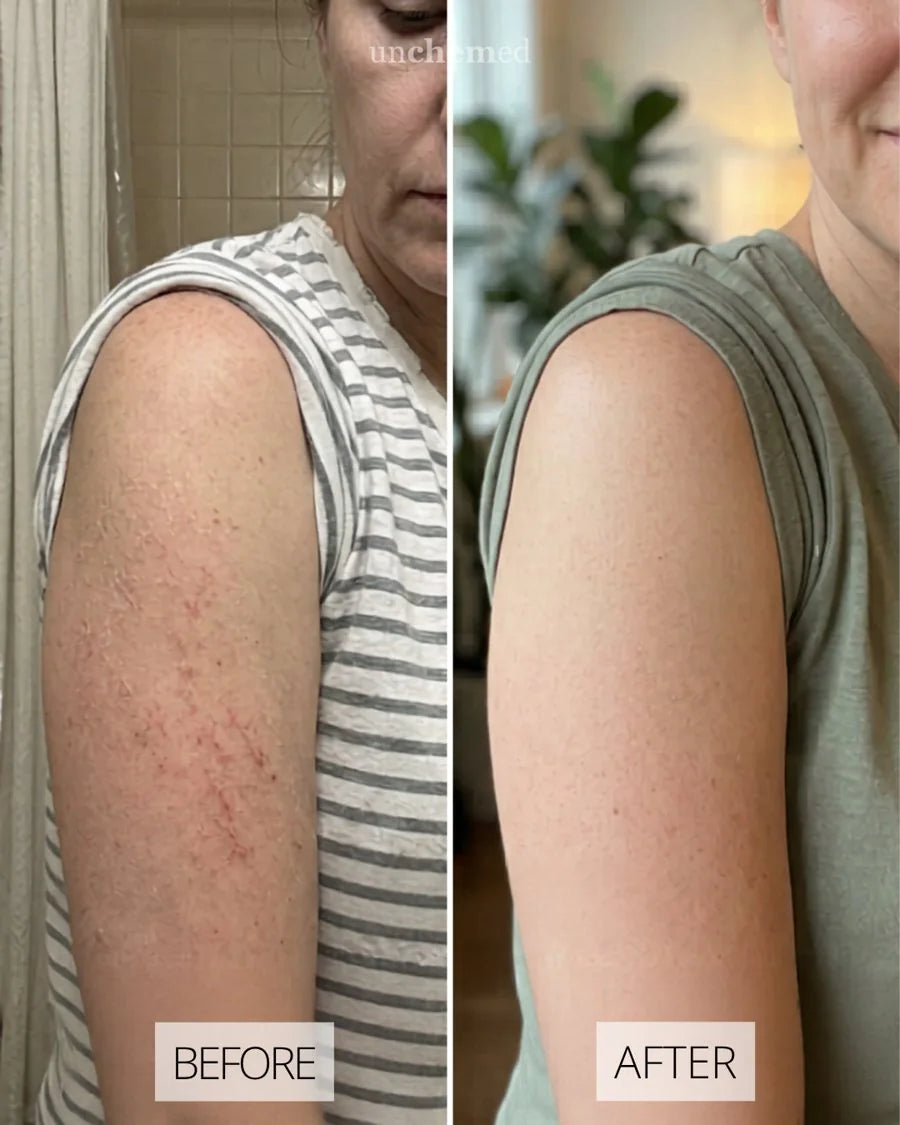 Before and after with Unchemed