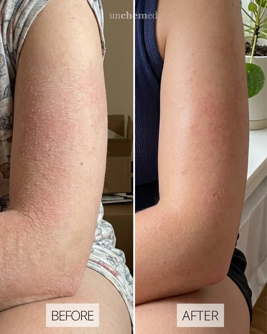 Before and after with Unchemed