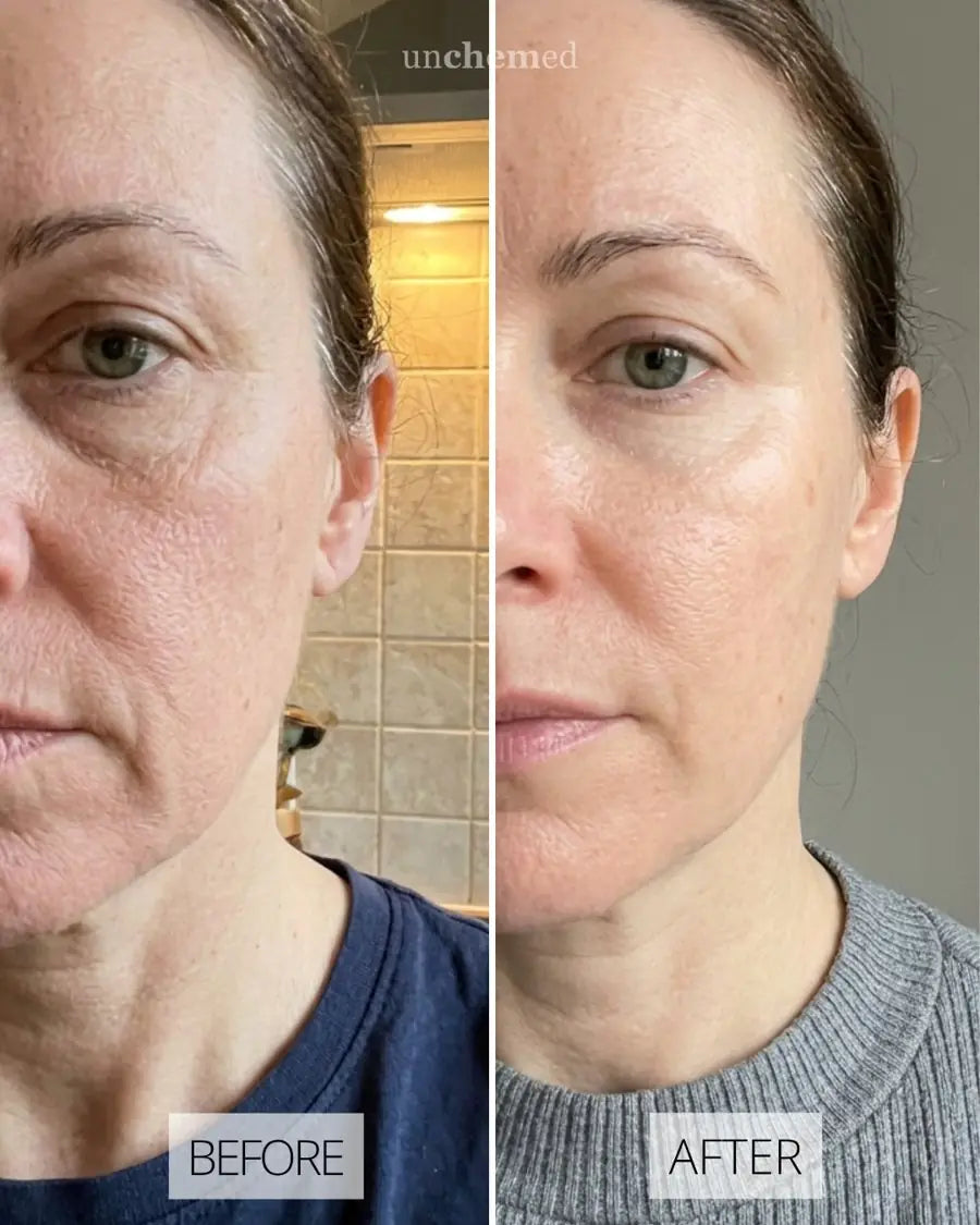 Before and after with Unchemed