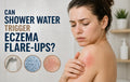 Can Shower Water Trigger Eczema Flare-Ups?