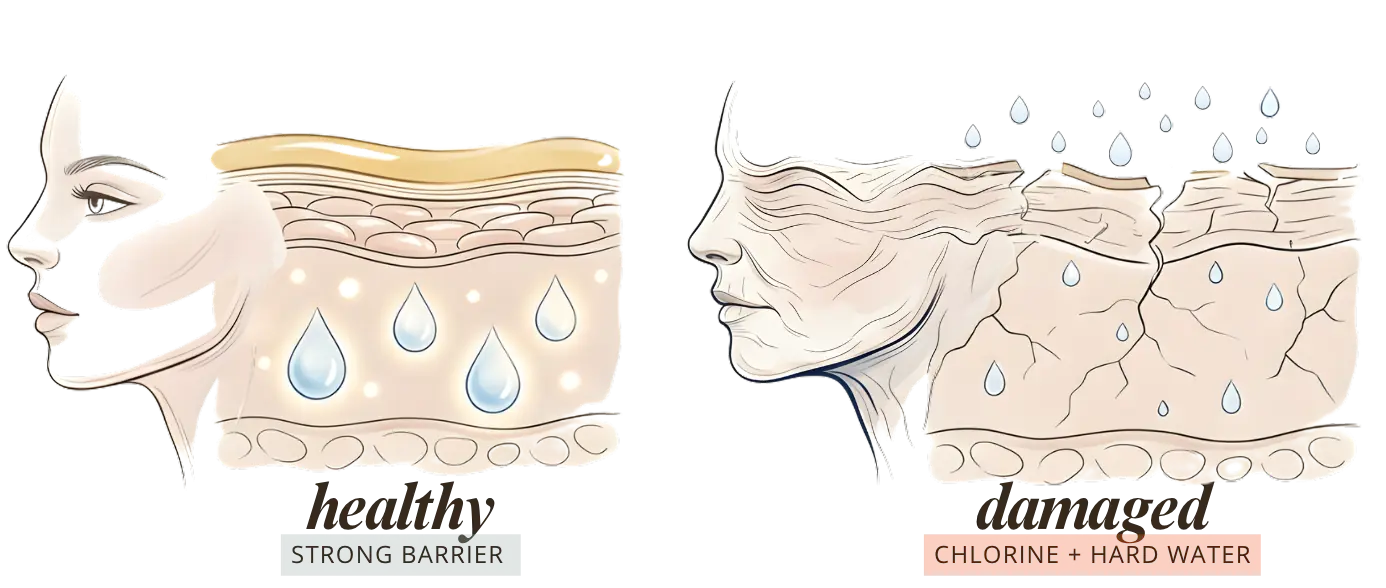 Healthy skin barrier versus barrier damaged by chlorine and hard water